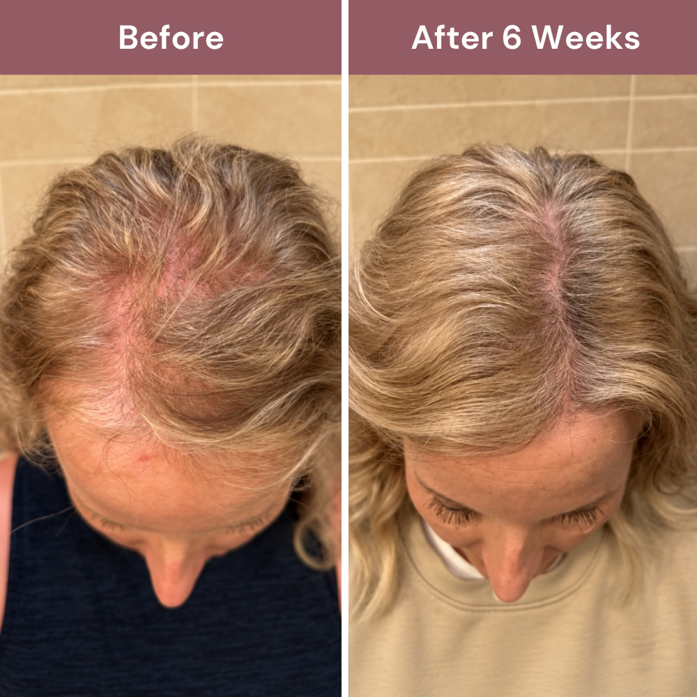 Refollia | Daily Hair Complex