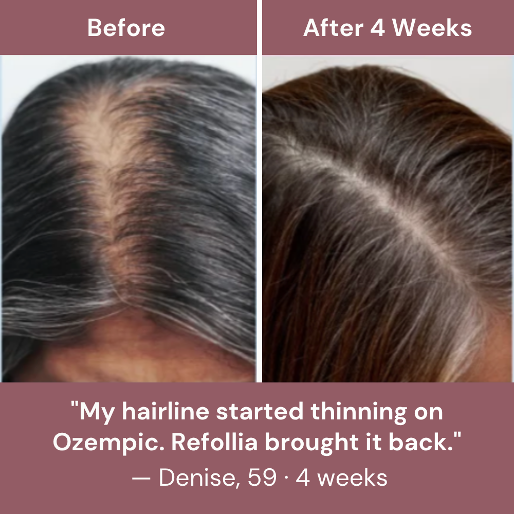 Refollia | Daily Hair Complex